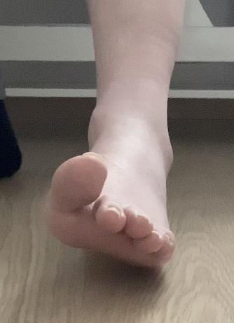 Inwersyjne ustawienie stopy może zwiększać ryzyko uszkodzenia struktur więzadłowych stawu skokowego