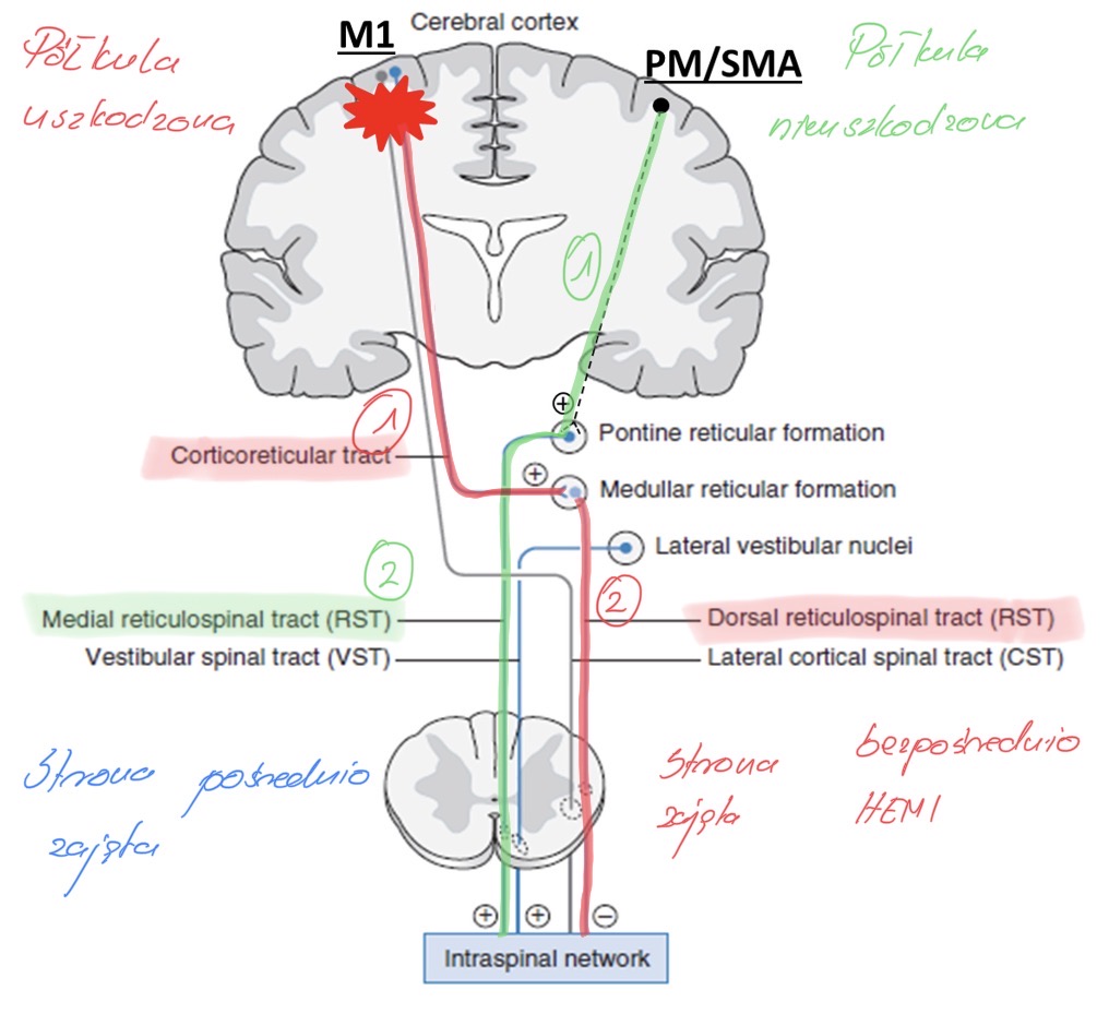 Opis patofizjologii spastyczności po udarze, nieprawidłowej synergii i zaburzonej kontroli motorycznej