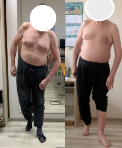 Faza podporu na lewej kończynie dolnej