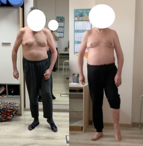 Faza podporu na prawej kończynie dolnej